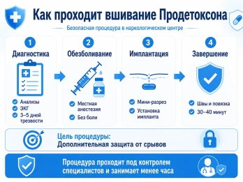 Имплантация Продетоксон в Байкальске